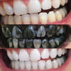 Blanqueamiento dental - blanquear los dientes con carbón activado