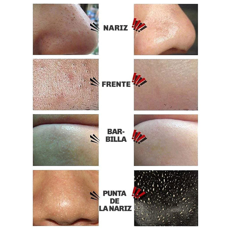 Mascarilla Anti-Puntos Negros