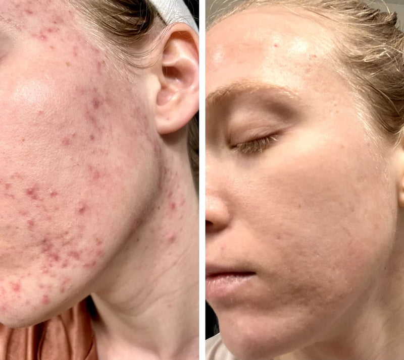 Máscara LED LUMIDARK