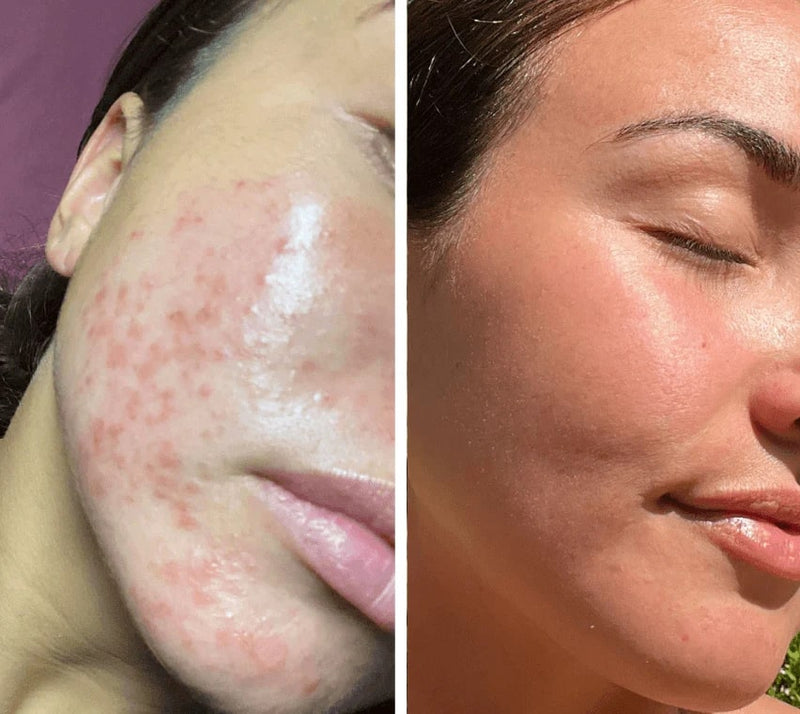 Máscara LED LUMIDARK