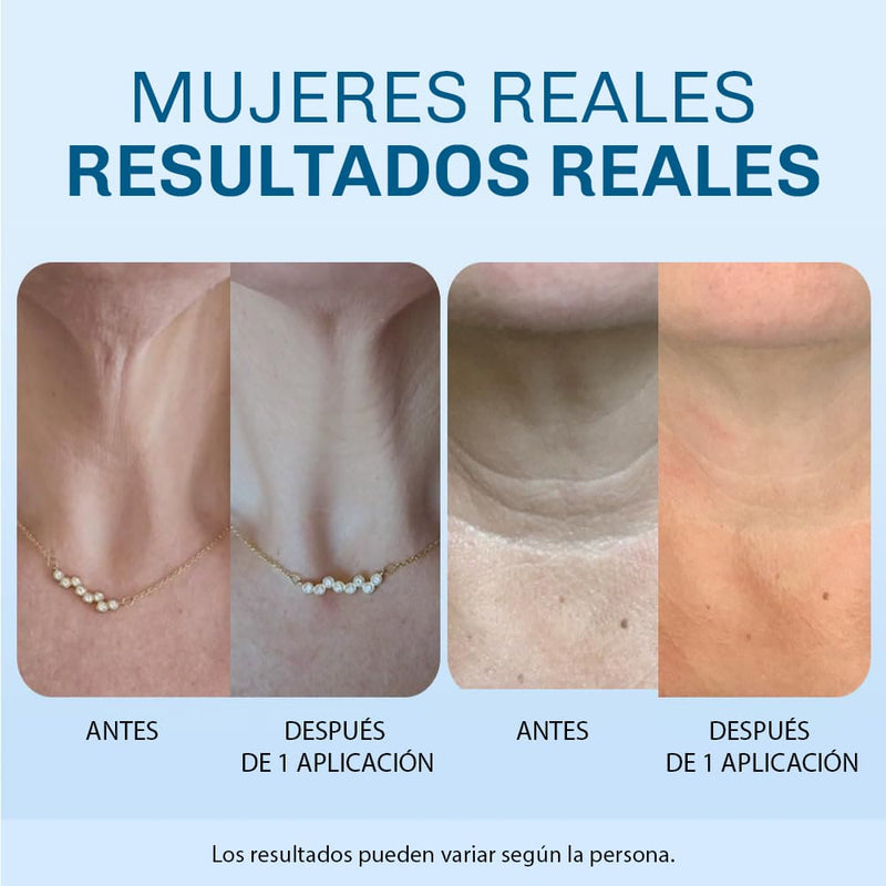 Crema Lifting para Cuello
