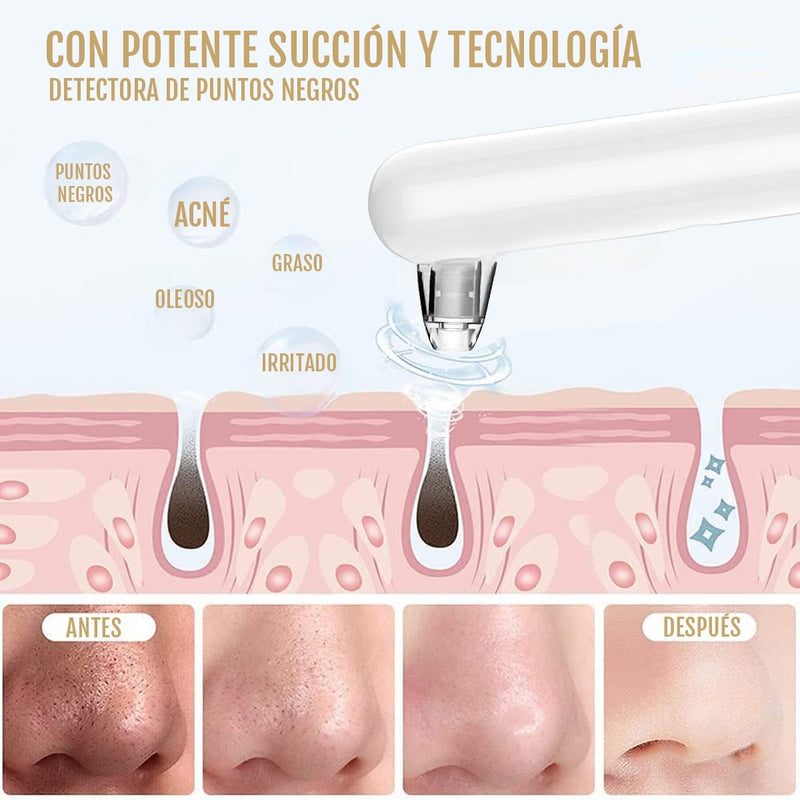 Set Eliminador de Puntos Negros