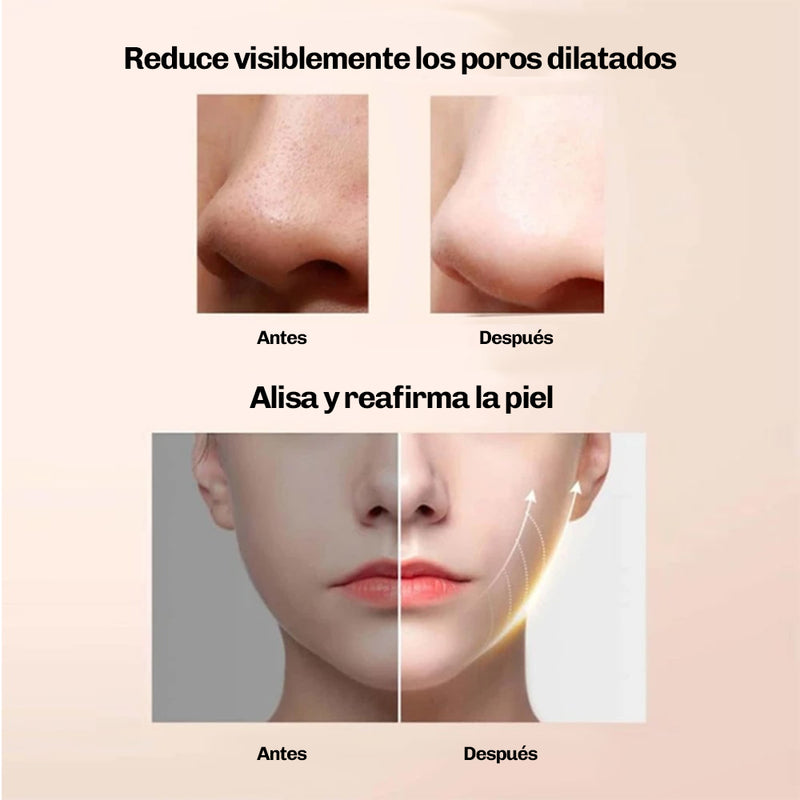 Peeling Ultrasónico DermaGlow 5