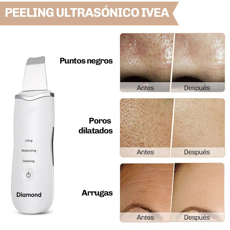 Peeling Ultrasónico DermaGlow 5