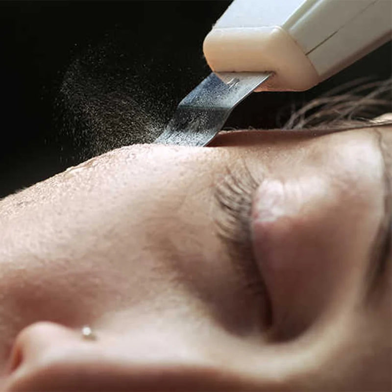 Peeling Ultrasónico DermaGlow 5